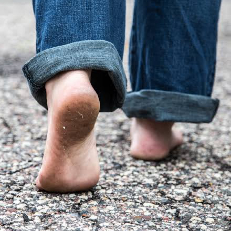 足の指を解放せよ