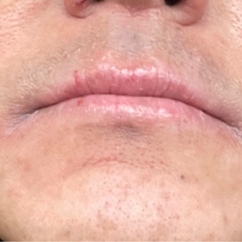 #2379 自己治癒力の劣化に…