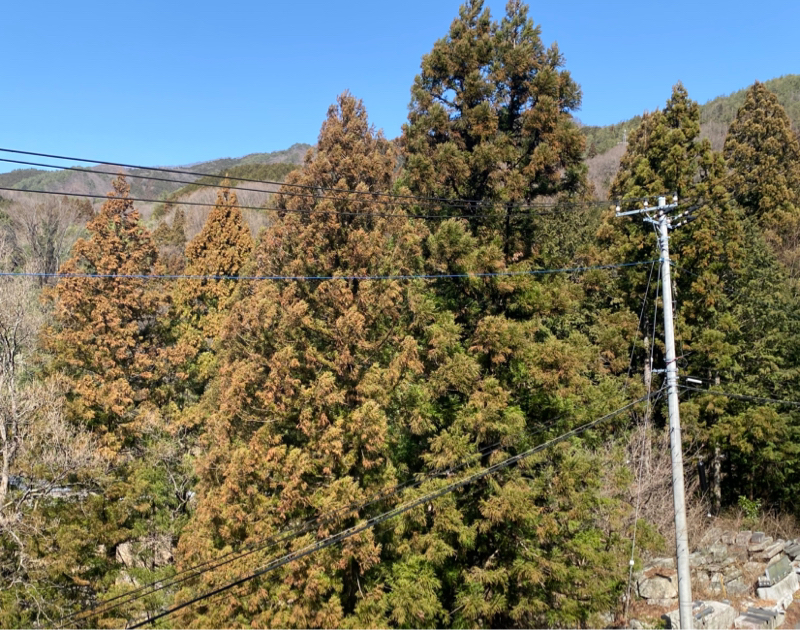 第253回 イライラしすぎ/前頭前野