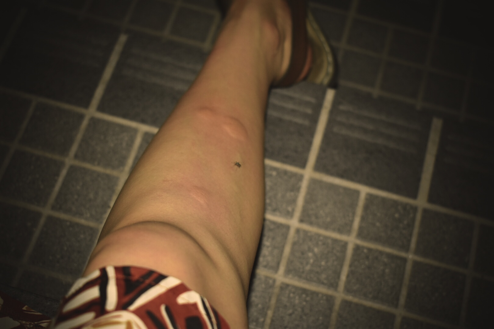 1.足が臭い悩み