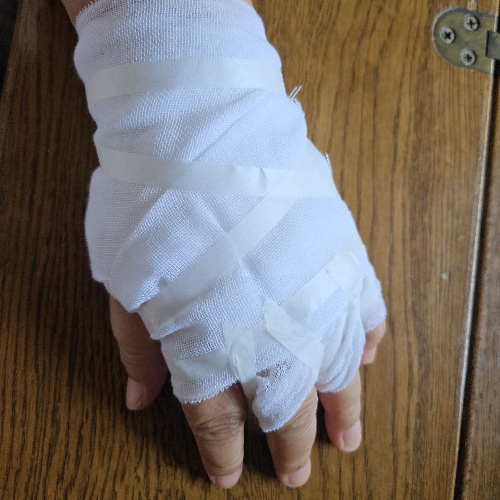 エコキュートでやけどしたのでメーカーさんが調査に来ていました
