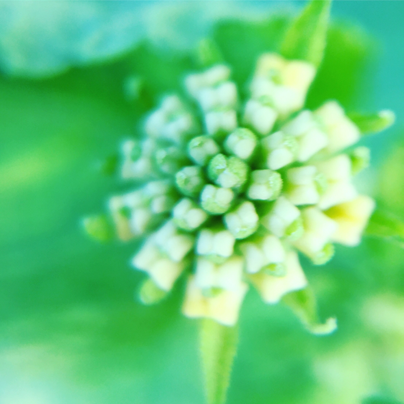 2:歯列矯正のはなし