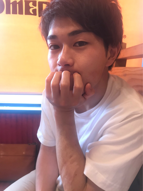 口臭がキツい人との付き合い方ってどうする？