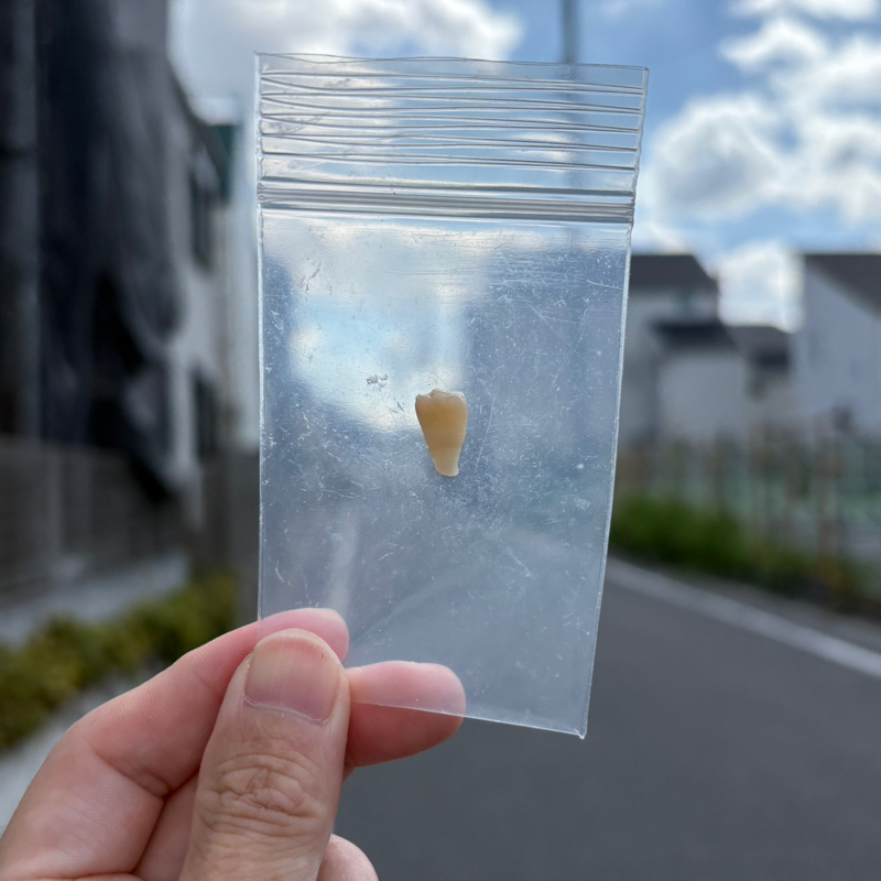 11/20生配信の告知📣＆通ってる歯医者さん事情🦷🦷🦷