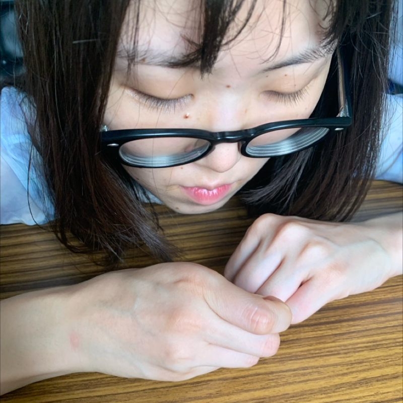 #1047 歯痛の治療