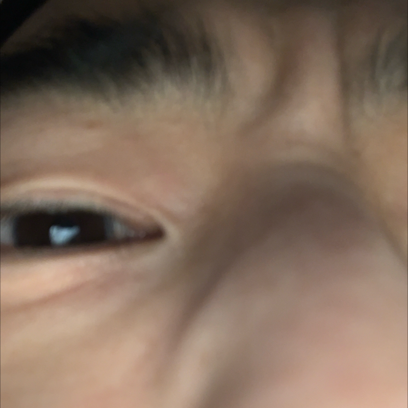 #1222 差し歯とは