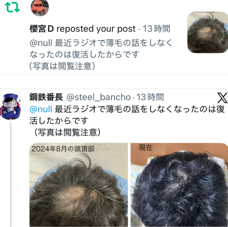 第373回　何故 自分の薄毛頭頂部をアップしたのか？