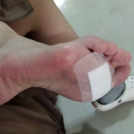 今まで一番痛かった出来事