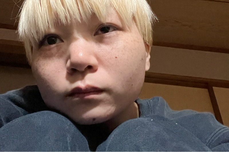 #57 過去1番ひどい