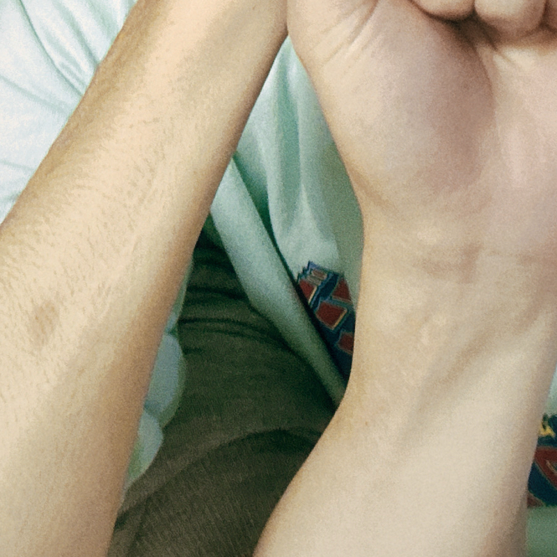 #12 続　骨折した話は正直聞いてて骨が折れる！