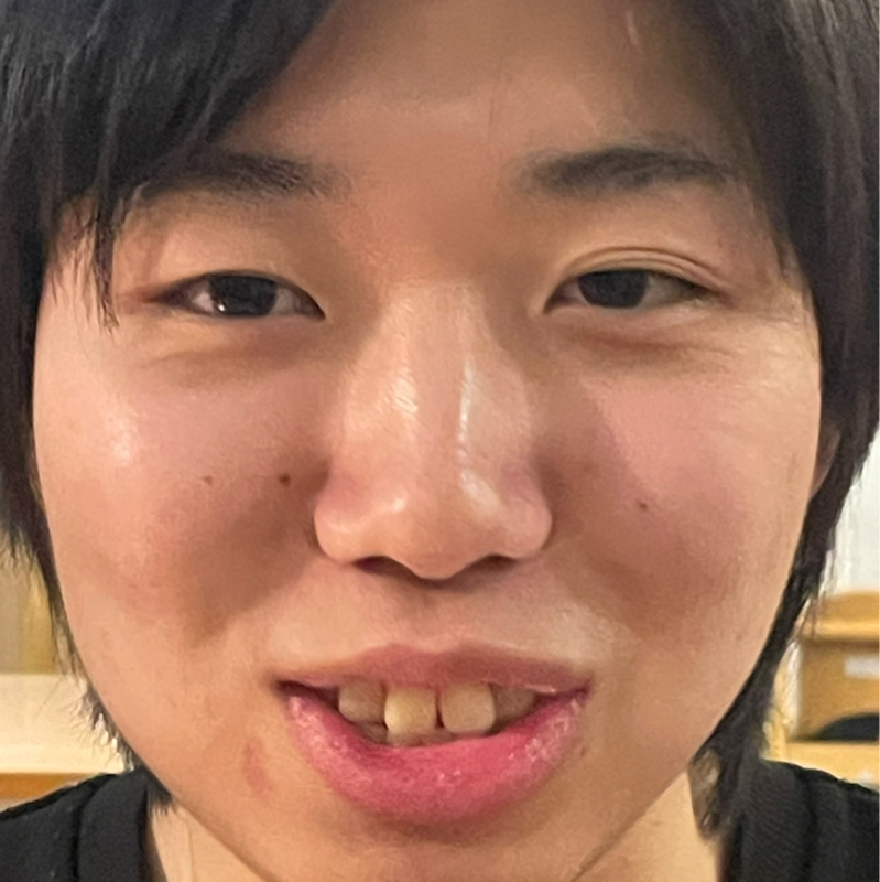 #19 佐井銀次郎、襲来