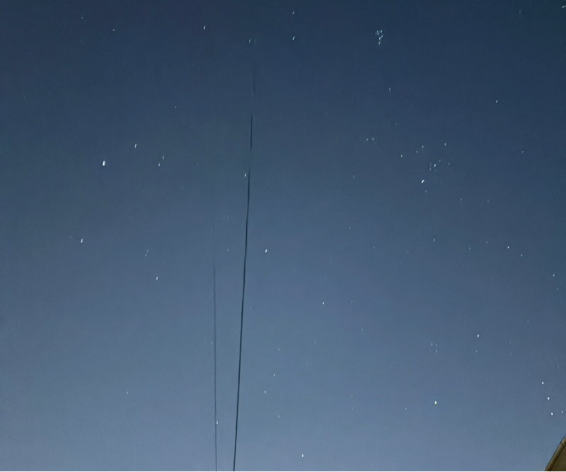 長男の肩が脱臼…手術になるかも。